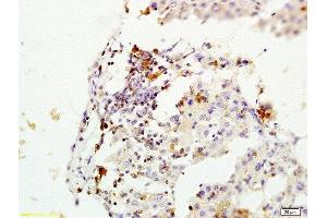 Formalin-fixed and paraffin embedded rat liver labeled with Rabbit Anti-MGMT Polyclonal Antibody, Unconjugated  at 1:200 followed by conjugation to the secondary antibody and DAB staining