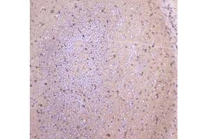 IHC testing of FFPE mouse brain tissue with WWOX antibody at 1ug/ml. (WWOX anticorps)