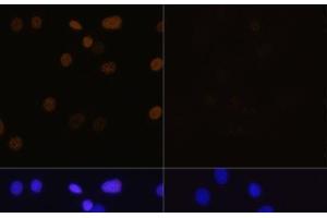 Immunofluorescence analysis of C6 cells using Acetyl-Histone H4-K16 Polyclonal Antibody at dilution of 1:100. (Histone H4 anticorps  (acLys16))