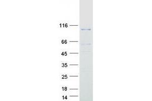Validation with Western Blot