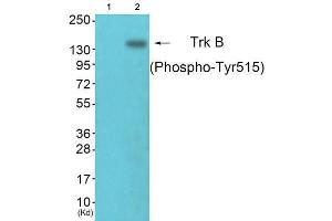 Western Blotting (WB) image for anti-Neurotrophic Tyrosine Kinase, Receptor, Type 2 (NTRK2) (pTyr515) antibody (ABIN1847227) (TRKB anticorps  (pTyr515))