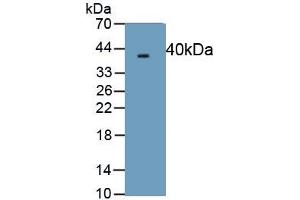 Detection of Recombinant PINP, Human using Monoclonal Antibody to Procollagen I N-Terminal Propeptide (PINP)