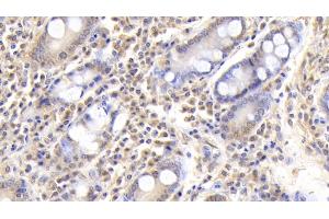 Detection of FGB in Human Small intestine Tissue using Monoclonal Antibody to Fibrinogen Beta Chain (FGB)