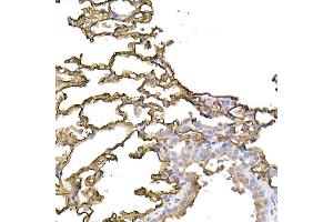 Immunohistochemistry of paraffin-embedded human tonsil using ICAM-1/CD54 Rabbit pAb (ABIN6129231, ABIN6142118, ABIN6142120 and ABIN6221235) at dilution of 1:100 (40x lens).