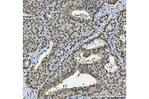 IHC analysis of PC4/SUB1 using anti-PC4/SUB1 antibody (ABIN7602185). (SUB1 anticorps  (AA 62-127))