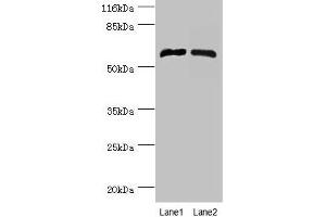 Western blot All lanes: CYP4F11 antibody at 2 μg/mL Lane 1: Mouse liver tissue Lane 2: Mouse kidney tissue Secondary Goat polyclonal to rabbit IgG at 1/10000 dilution Predicted band size: 61 kDa Observed band size: 61 kDa (CYP4F11 anticorps  (AA 38-524))