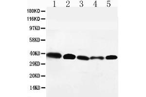 Anti-GPR2/CCR10 antibody, Western blotting Lane 1: HELA Cell Lysate Lane 2: SW620 Cell Lysate Lane 3: A549 Cell Lysate Lane 4: MM231 Cell Lysate Lane 5: SMMC Cell Lysate