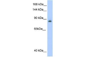 WB Suggested Anti-ACO1 Antibody Titration:  0. (Aconitase 1 anticorps  (N-Term))