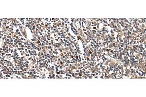 Immunohistochemistry of paraffin-embedded Human tonsil tissue using HOXB9 Polyclonal Antibody at dilution of 1:45(x200) (HOXB9 anticorps)