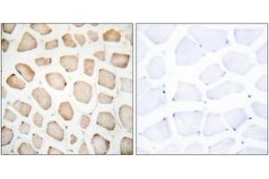 Immunohistochemistry analysis of paraffin-embedded human skeletal muscle tissue, using CHOP (Ab-30) Antibody. (DDIT3 anticorps  (AA 15-64))