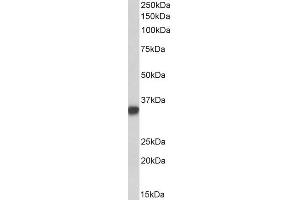 ABIN2613403 (0. (CD74 anticorps  (Internal Region))