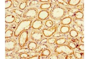Immunohistochemistry of paraffin-embedded human kidney tissue using ABIN7151711 at dilution of 1:100 (LACTB2 anticorps  (AA 6-288))