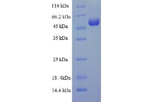 SDS-PAGE (SDS) image for Matrix Metallopeptidase 13 (Collagenase 3) (MMP13) (AA 104-471) protein (His-SUMO Tag) (ABIN5709941)