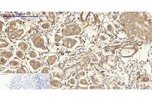 Immunohistochemistry of paraffin-embedded Human stomach tissue using CAV1 Polyclonal Antibody at dilution of 1:200. (Caveolin-1 anticorps)