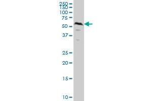 SMAD1 monoclonal antibody (M04A), clone 2A1 Western Blot analysis of SMAD1 expression in HeLa .