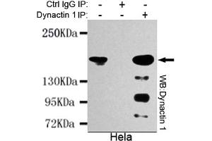 Immunoprecipitation analysis of Hela cell lysates using Dynactin 1 mouse mAb. (Dynactin 1 anticorps  (N-Term))