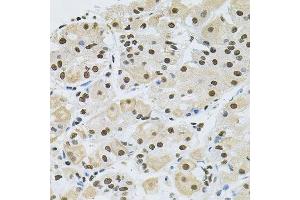 Immunohistochemistry of paraffin-embedded human stomach using MAPK8 antibody.