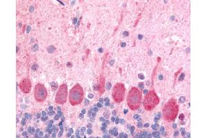 Anti-HCRTR1 / Orexin Receptor 1 antibody IHC of rat brain, Purkinje neurons. (HCRTR1 anticorps  (Extracellular Domain))