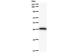 Western Blotting (WB) image for anti-F-Box Protein, Helicase, 18 (FBXO18) antibody (ABIN931163) (FBXO18 anticorps)