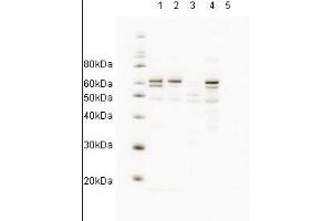Western blot showing anti-HR23A antibody detects endogenous human HR23A. (RAD23A anticorps  (AA 122-135))