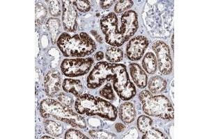 Immunohistochemical staining of human kidney with ZNF519 polyclonal antibody  shows strong cytoplasmic positivity in cells in tubules. (ZNF519 anticorps)