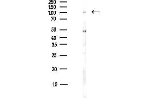 anti-Megakaryoblastic Leukemia (Translocation) 1 (MKL1) (N-Term) antibody