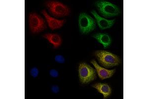 ABIN6259873 and ABIN6273990 staining Hela cells by IF/ICC.