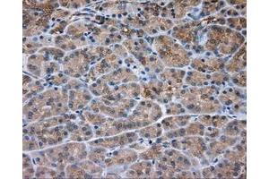 Immunohistochemical staining of paraffin-embedded Kidney tissue using anti-PRKAR2A mouse monoclonal antibody.