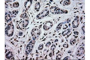 Immunohistochemical staining of paraffin-embedded breast tissue using anti-MAPK1 mouse monoclonal antibody. (ERK2 anticorps)