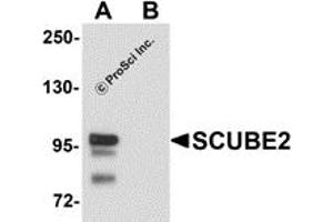 Western Blotting (WB) image for anti-Signal Peptide, CUB Domain, EGF-Like 2 (SCUBE2) (Middle Region) antibody (ABIN1031083) (SCUBE2 anticorps  (Middle Region))