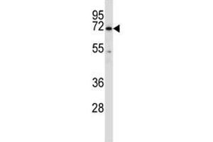 BTK antibody western blot analysis in HL-60 lysate