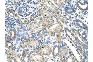 PRPS2 antibody was used for immunohistochemistry at a concentration of 4-8 ug/ml to stain Epithelial cells of renal tubule (arrows) in Human Kidney. (PRPS2 anticorps  (Middle Region))