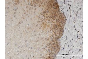 Immunoperoxidase of monoclonal antibody to MAGED1 on formalin-fixed paraffin-embedded human esophagus.