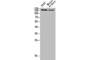 Western blot analysis of 293T lysate, mouse kidney antibody was diluted at 500. (FLT4 anticorps  (AA 640-700))