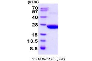 SDS-PAGE (SDS) image for Peroxiredoxin 1 (PRDX1) (AA 1-199) (Active) protein (His tag) (ABIN6387795) (Peroxiredoxin 1 Protein (PRDX1) (AA 1-199) (His tag))