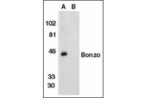 Image no. 2 for anti-Chemokine (C-X-C Motif) Receptor 6 (CXCR6) antibody (ABIN372833) (CXCR6 anticorps)