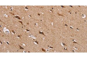 Immunohistochemistry of paraffin-embedded Human brain using HTR3C Polyclonal Antibody at dilution of 1:30 (HTR3C anticorps)