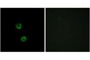 Immunofluorescence analysis of MCF7 cells, using TMEM30C Antibody. (TMEM30C anticorps  (AA 51-100))