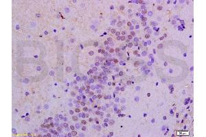 Formalin-fixed and paraffin embedded rat brain labeled with Anti-AMPK alpha-1/PRKAA1 Polyclonal Antibody, Unconjugated (ABIN737886) at 1:200 followed by conjugation to the secondary antibody and DAB staining.