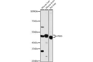 Western blot analysis of extracts of various cell lines, using PRR5 antibody (ABIN7269555) at 1:1000 dilution. (PRR5 anticorps  (AA 109-388))