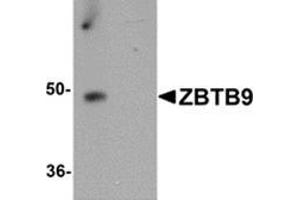 Western blot analysis of ZBTB9 in mouse heart tissue lysate with ZBTB9 antibody at 1 μg/ml in (A) the absence and (B) the presence of blocking peptide. (ZBTB9 anticorps  (C-Term))