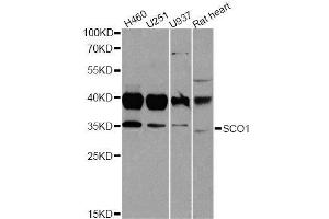 Western blot analysis of extracts of various cell lines, using SCO1 antibody. (SCO1 anticorps  (AA 1-160))