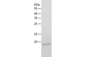 Western Blotting (WB) image for Chemokine (C-C Motif) Ligand 1 (CCL1) (AA 24-96) (Active) protein (His tag) (ABIN7122261)