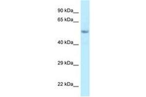 Image no. 1 for anti-Family with Sequence Similarity 114, Member A2 (FAM114A2) (C-Term) antibody (ABIN6748046) (FAM114A2 anticorps  (C-Term))