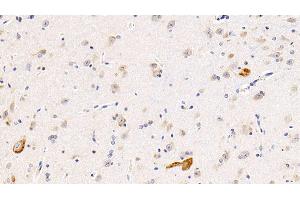 Detection of IL11Ra in Human Cerebrum Tissue using Polyclonal Antibody to Interleukin 11 Receptor Alpha (IL11Ra) (IL11RA anticorps  (AA 59-220))