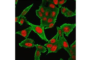 Immunofluorescence Analysis of HeLa cells labeling Smooth Muscle Actin with Smooth Muscle Actin MAb (1A4 + ACTA2/791) followed by Goat anti-Mouse IgG-CF488(Green).