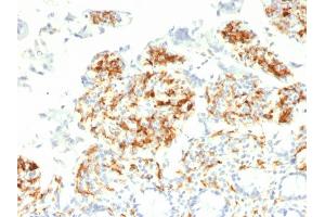 Formalin-fixed, paraffin-embedded human Small Intestine stained with CD209 Mouse Monoclonal Antibody (C209/1781).