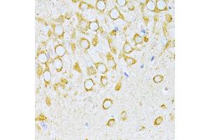 Immunohistochemistry of paraffin-embedded rat brain using VARS antibody (ABIN1683239, ABIN3018665, ABIN3018666 and ABIN6220533) at dilution of 1:100 (40x lens).