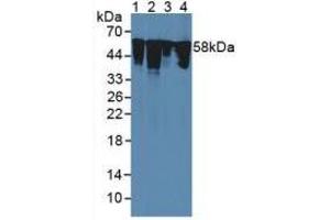 Figure. (Vimentin anticorps  (AA 2-466))