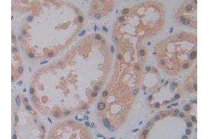 Detection of PTF1a in Human Kidney Tissue using Polyclonal Antibody to Pancreas Specific Transcription Factor 1a (PTF1a)